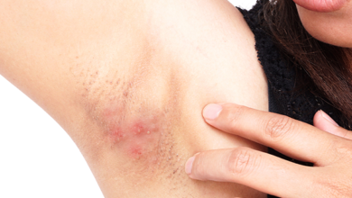 Photo of Koltuk altı ve kasık bölgesindeki yaraları ihmal etmeyin!