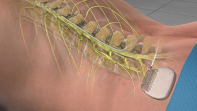 Photo of Geçmeyen bel ağrısına omurga pili