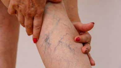 Photo of Varisin kaynağı hareketsizlik