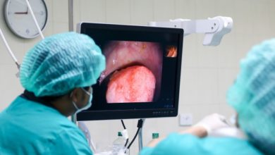 Photo of ‘EUS’ ile derine yerleşmiş tümörler daha detaylı görüntüleniyor