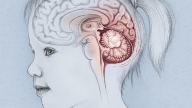 Photo of Çocuklarda beyin tümörünün belirtileri