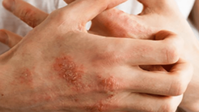 Photo of Dezenfektanlar cildinizi bozmasın