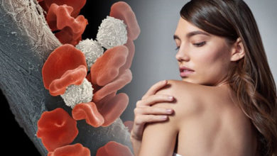 Photo of Lenf ve kan kanseri hastaları dikkat