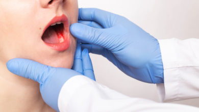 Photo of Diş eti kanaması ihmale gelmez