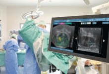 Photo of Belirti vermiyor, sessizce ilerliyor!