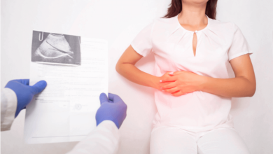 Photo of Yüksek kolesterol safrayı vuruyor