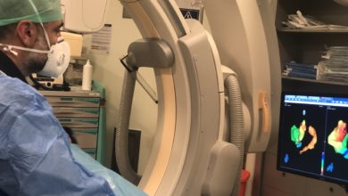 Photo of Ritim bozukluğuna ablasyon tedavisi