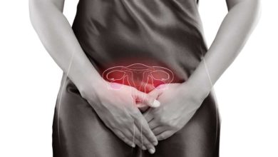 Photo of Çikolata kistinin belirtileri