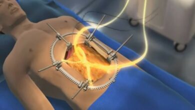 Photo of Sıcak kemoterapi kanser hücrelerini kıskaca alıyor