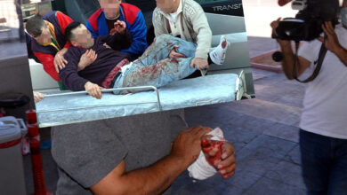 Photo of Kurban keserken yaralanmada ne yapmalı?