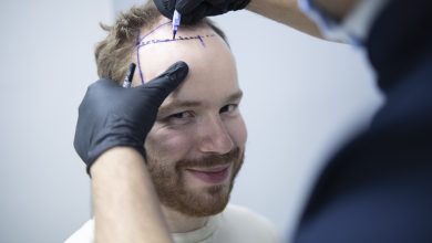 Photo of Saç ekimi özgüveni artırıyor