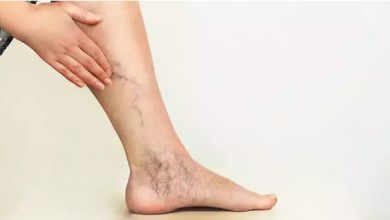 Photo of Varise ne iyi gelir?