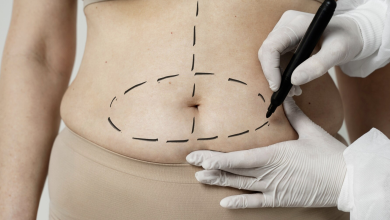 Photo of Karın estetiğinde merak edilenler