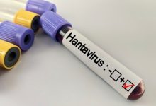 Photo of Hantavirüs belirtileri…