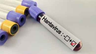 Photo of Hantavirüs belirtileri…